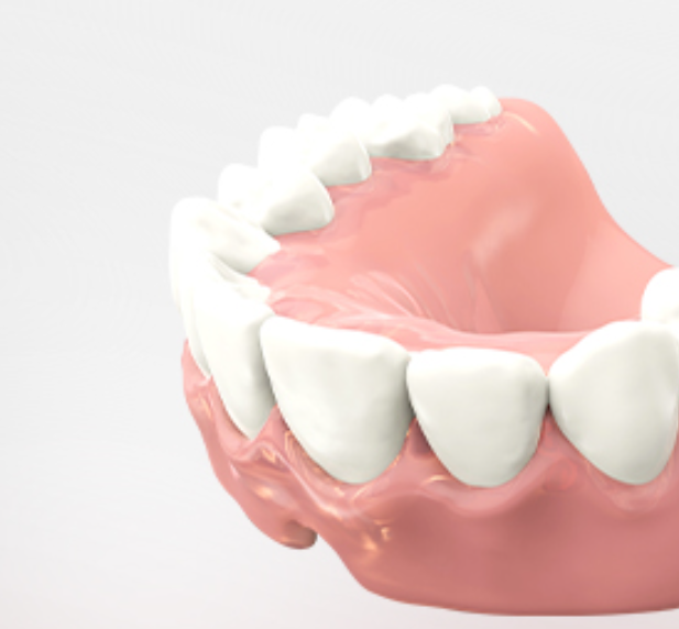 섬세한 디자인<br>
메인 심미치료